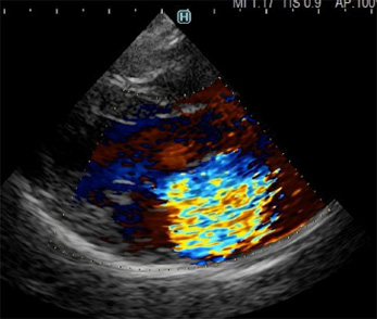エコー画像サンプル3