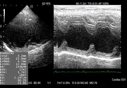 エコー画像サンプル4